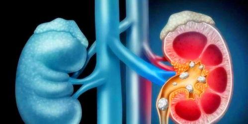 肾结石可以吃莲瓜视频,天然食材缓解结石困扰